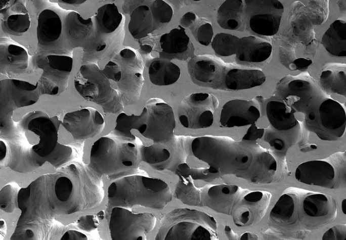 Bone-Microscopic View